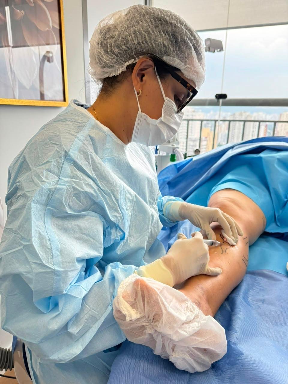 microcirurgia de varizes, tratamentos em são paulo, home dr. mychelly carvalho
